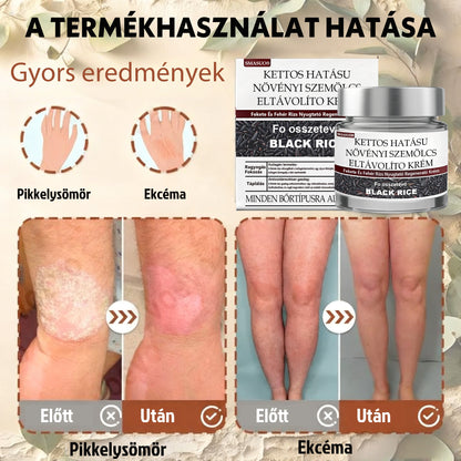 ✅ 𝙎𝙈𝘼𝙎𝙐𝙊® Fekete Rizses Bőrregeneráló Krém 👨‍⚕️ (Szemölcsök, bőrkinövések, foltok és hiperpigmentáció kezelésére)🍀