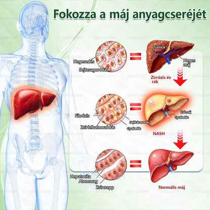 🌟Korlátozott készlet! A SMASUO® 🎁 további 30% kedvezményt kínál! Helyezze vissza testét és egészségét. Cselekedjen most – ez a lehetőség nem tart sokáig.