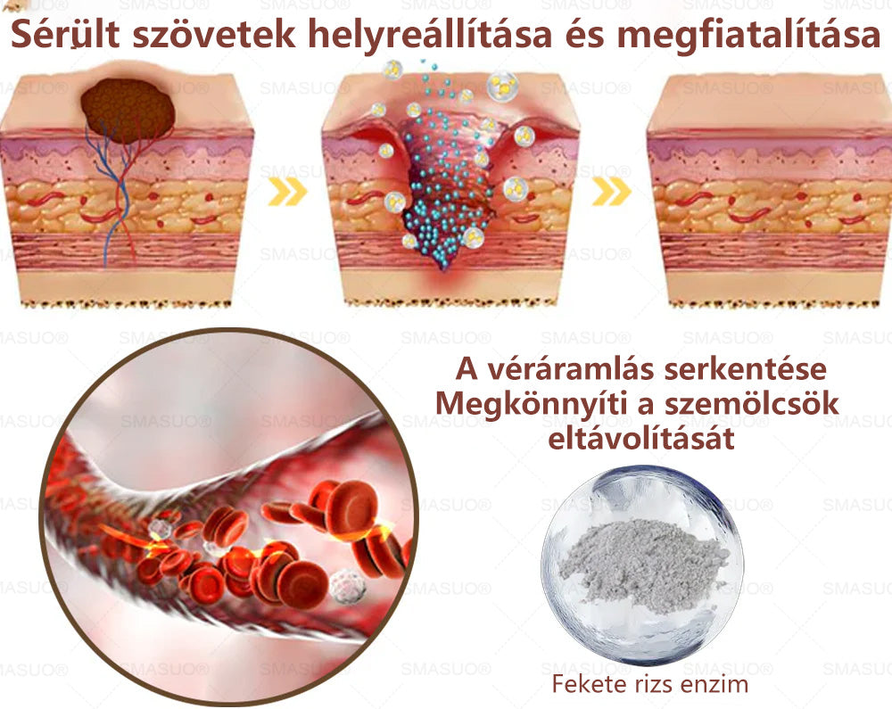 ✅ 𝙎𝙈𝘼𝙎𝙐𝙊® Fekete Rizses Bőrregeneráló Krém 👨‍⚕️ (Szemölcsök, bőrkinövések, foltok és hiperpigmentáció kezelésére)🍀