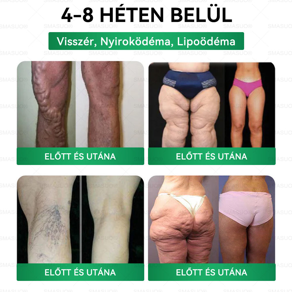 🌟Korlátozott készlet! A SMASUO® 🎁 további 30% kedvezményt kínál! Helyezze vissza testét és egészségét. Cselekedjen most – ez a lehetőség nem tart sokáig.